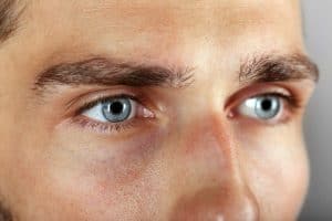 Blepharoplasty Greenwich, CT