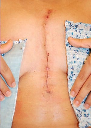 After Image: Scar Revision - front